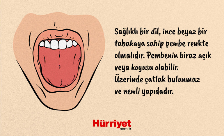Dildeki renk değişimleri hangi hastalıkların habercisi Sağlıklı dil nasıl anlaşılır