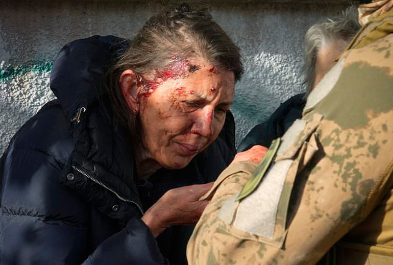 Putin, Kırımın intikamını Kievi vurarak almıştı... Füze saldırısında ölen doktorun hikâyesi ise herkesi ağlattı