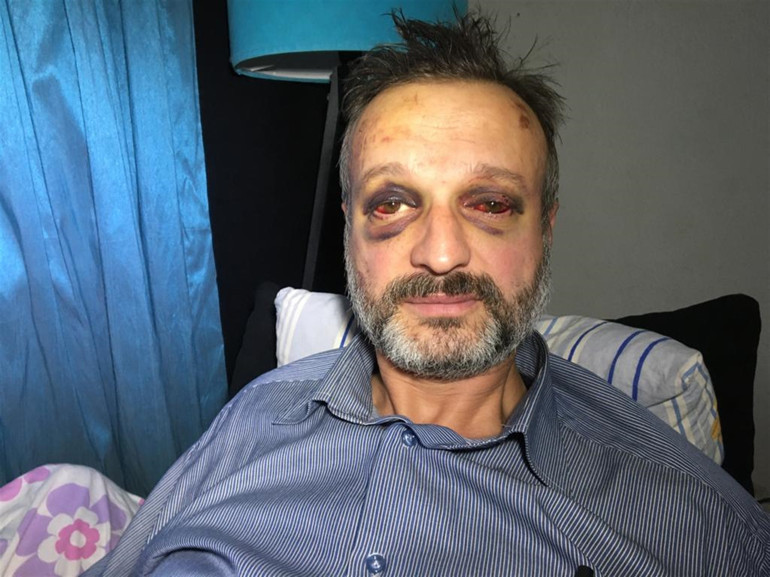 Bursada istek şarkı dehşeti Müzisyeni öldüresiye darbettiler