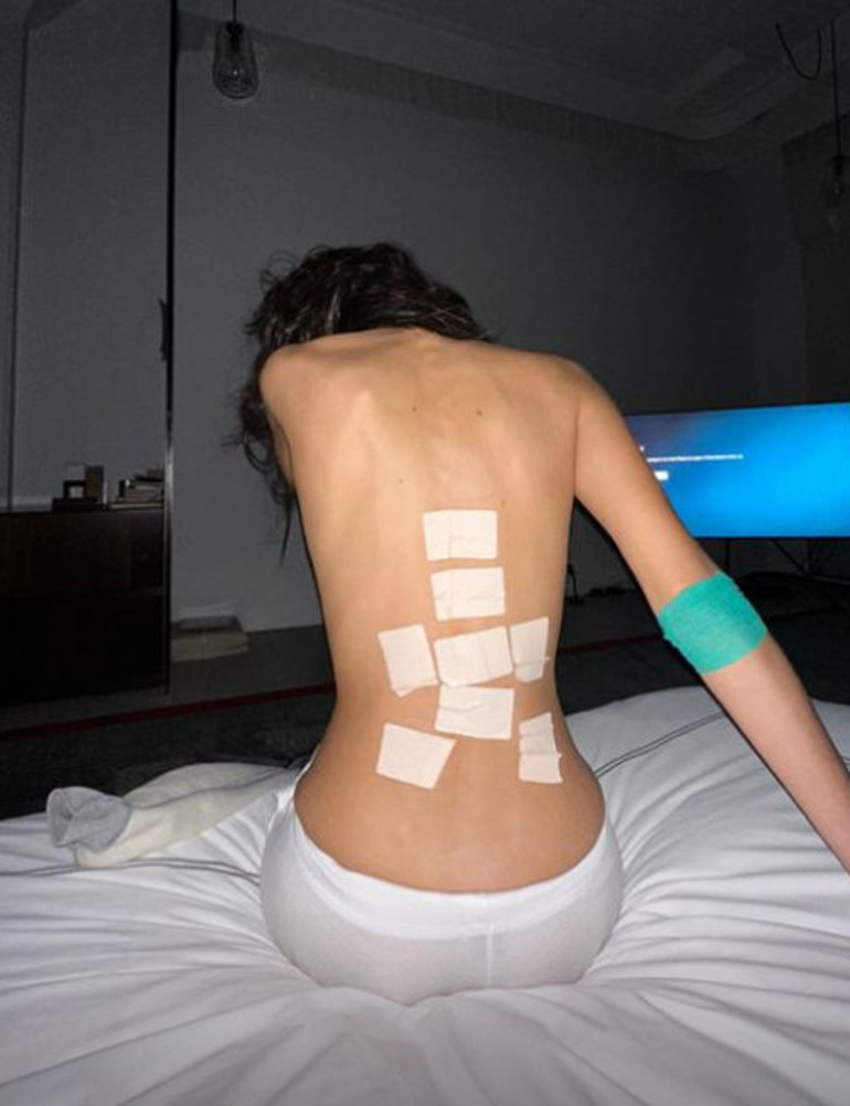 Bella Hadid oradan oraya koşturdu, gözünü hastanede açtı