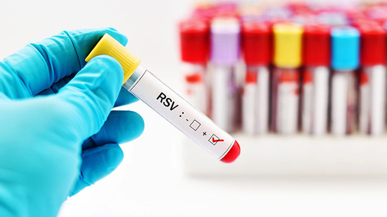 RSV’den korkalım mı