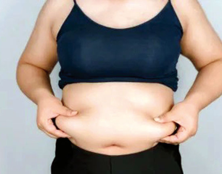 Karın germe operasyonu ve vücut şekillendirme