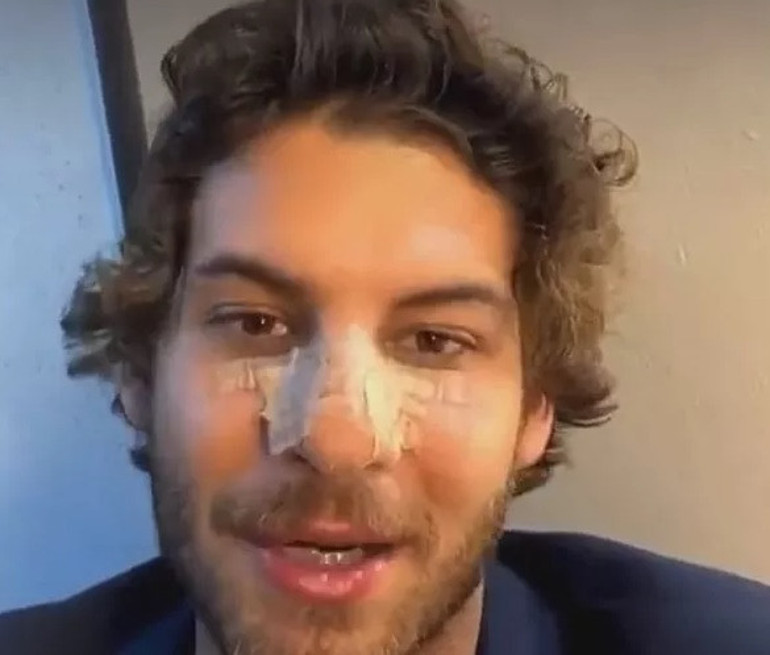 Babam 5 yaşındayken beni bıçakla kovaladı