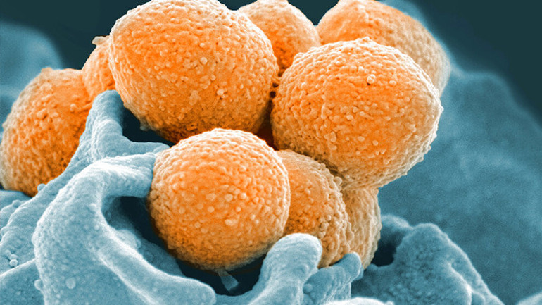 Strep A kabusu büyüyor: İngiltereden sonra şimdi de Hollanda Hastalığın neden aşısı yok