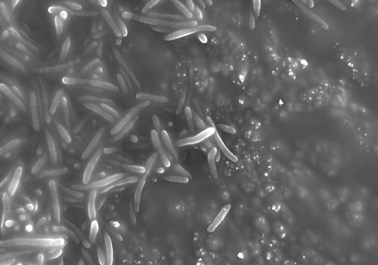 Türk bilim insanlarından umut verici keşif Çevre kirliliğine karşı savaşta silah olabilecek yeni bir bakteri bulundu | 7 SORU 7 YANIT