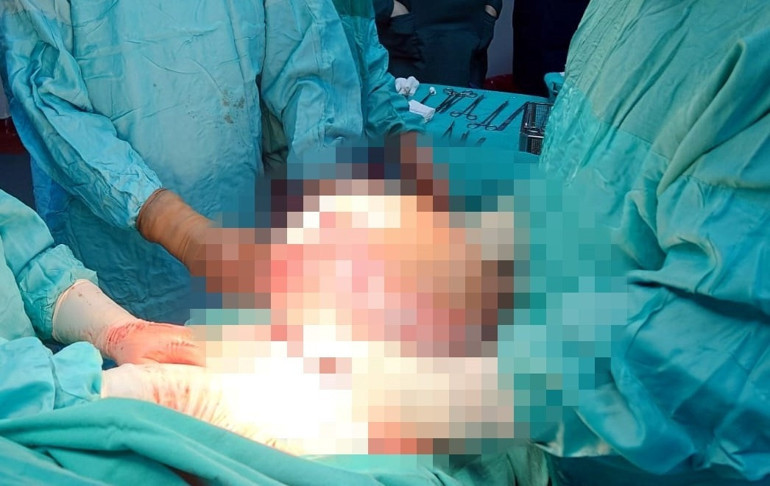 Şaşkına çeviren görüntü Karnından 7,5 kilo kitle çıktı