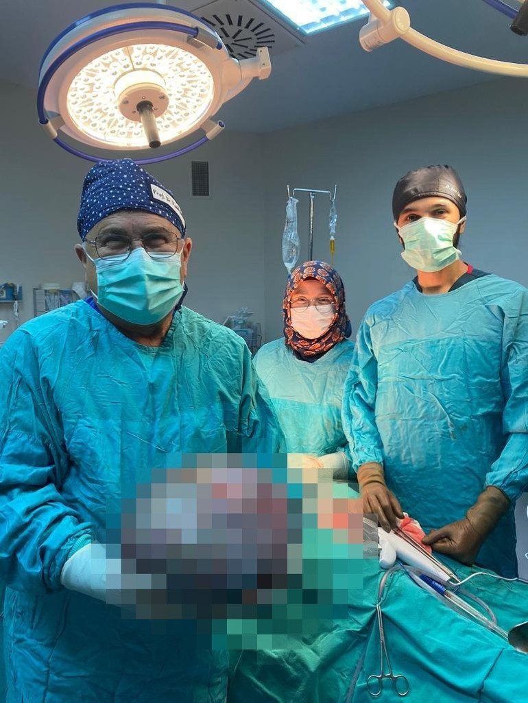 Şaşkına çeviren görüntü Karnından 7,5 kilo kitle çıktı
