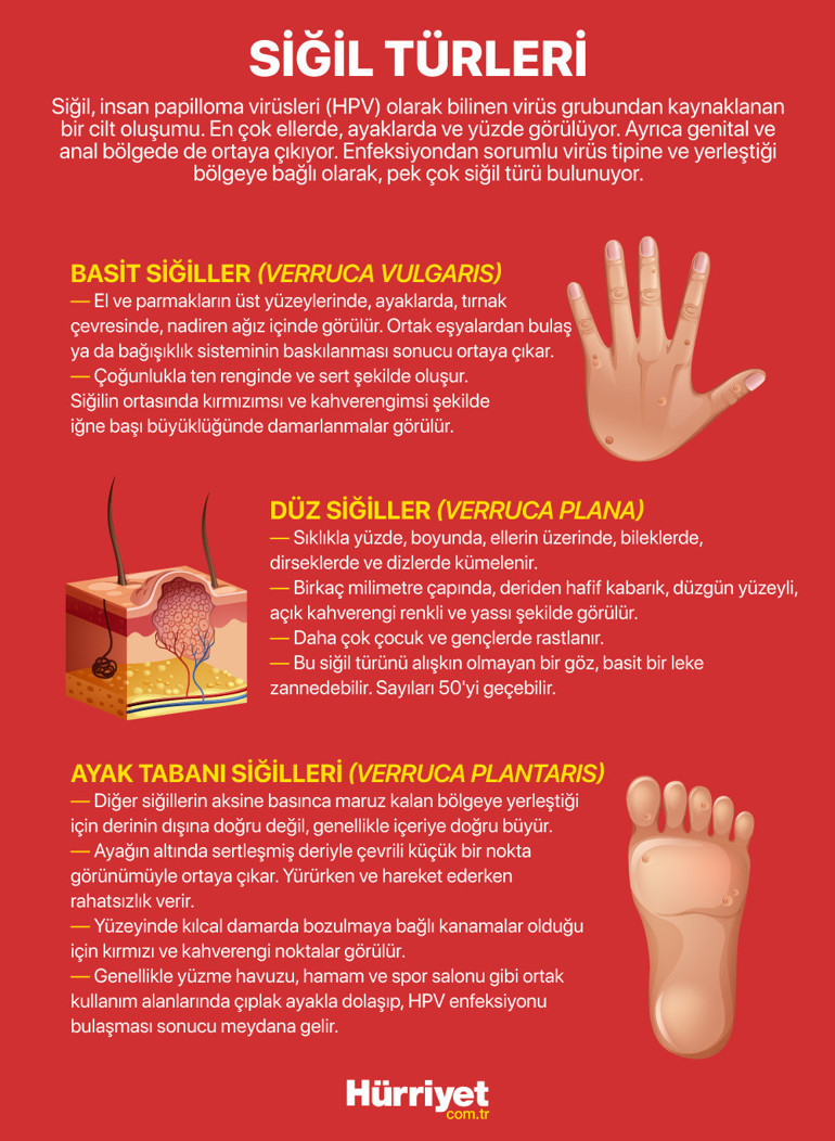 10 SORUDA SİĞİL DOSYASI | Kurbağa ellemekle bulaşır mı Sirke sürmek iyileştirir mi Hangi hastalıkların habercisi
