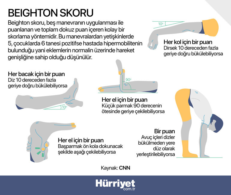 Esnek olmak kulağa hoş geliyor ama... Bende bir sorun var iyileşemiyorum