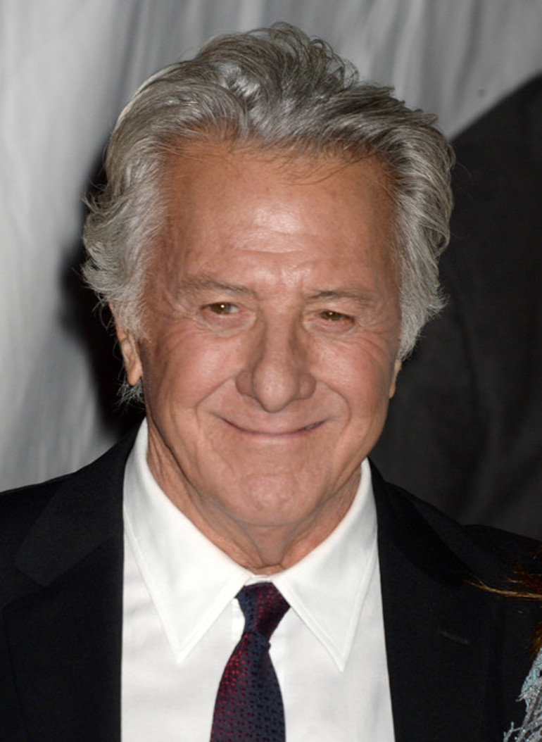 Madalyonun karanlık yüzü: Beni duş alırken izlemek istedi, film çekilsin diye katlandım