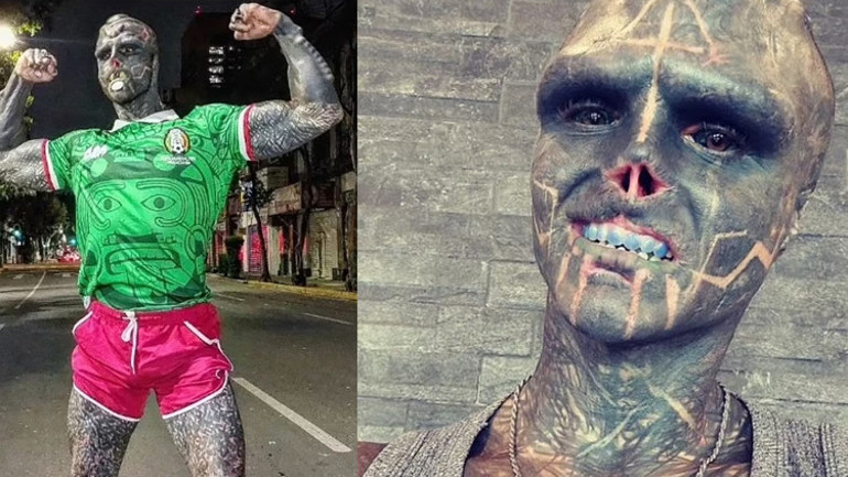 Kulaklarını, burnunu ve üst dudağını aldırdı...Yeni görüntüsü dehşete düşürdü: Restoranlar beni almıyor