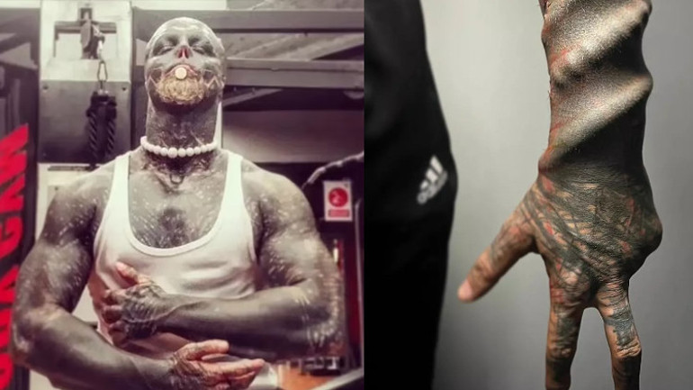 Kulaklarını, burnunu ve üst dudağını aldırdı...Yeni görüntüsü dehşete düşürdü: Restoranlar beni almıyor