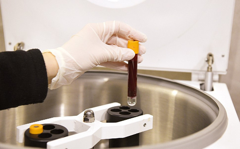 Dr. Servet Terziler yazdı: Kök hücre ile saç tedavisi