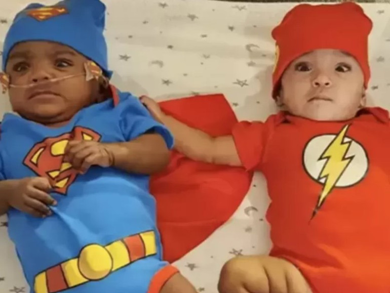 Dünyanın en erken doğan ikizleri...Guinness Rekorlar Kitabına girdiler