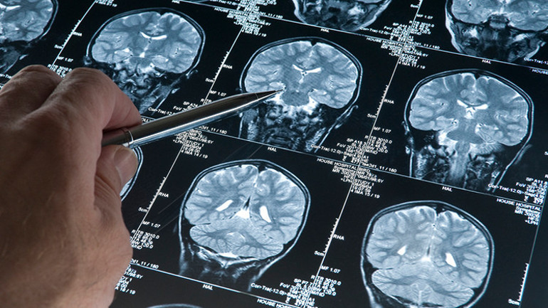 Koronavirüste bir ilk: Yüz körlüğü Hastalık sonrası babasını bile tanıyamadı...