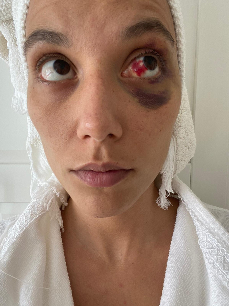 Ozan Güven darp iddialarıyla gündeme gelmişti... Bu kötü günler geride kalacak