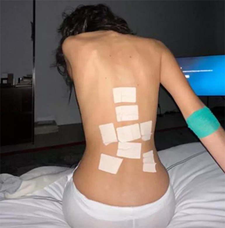 Güzellik, para, şöhret.. Her şeyi var ama sağlığı yok: Her gün tedavisi olmayan acılar çekiyorum