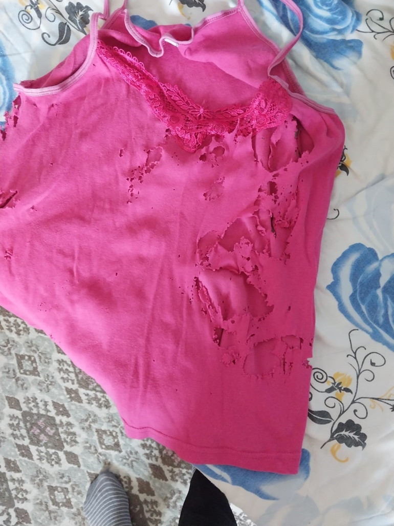 Lavabo açıcı bomba gibi patladı Yaşadığı dehşeti anlattı: Kolumdan vazgeçmiştim