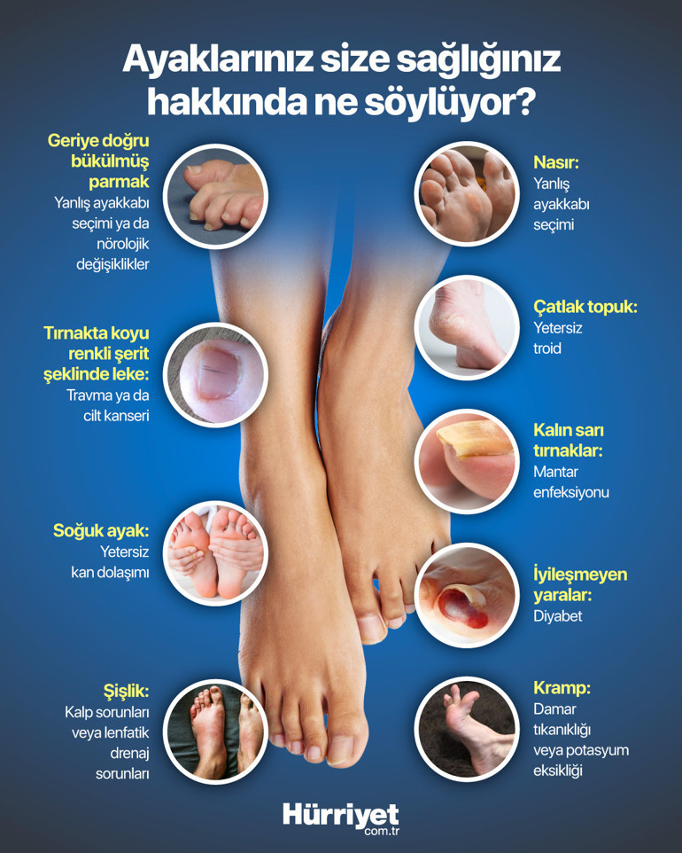 Soğuk ayaklar, topuk çatlağı, kalın tırnaklar... Ayaklarımız sağlığımız hakkında bize ne söylüyor