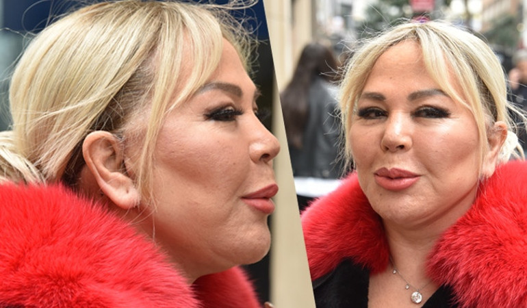 Son hali çok konuşulmuştu... Bengüden açıklama geldi