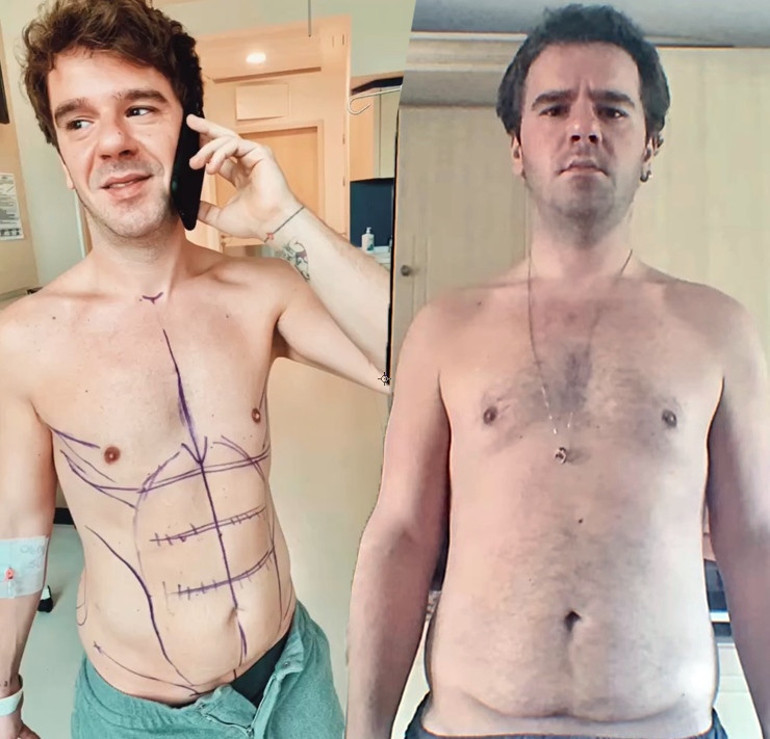 Sihirli Annemin Cemi 30 kilo verdi