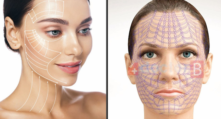 Op. Dr. Bülent Cihantimur: Örümcek ağı estetiği ile doğal gençlik