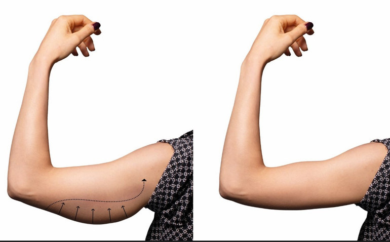 Op. Dr. Bülent Cihantimur: Örümcek ağı estetiği ile doğal gençlik