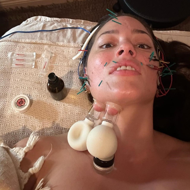 Ne botoks ne de dolgu… Ünlü model milyonlarca takipçisine güzellik sırrını verdi