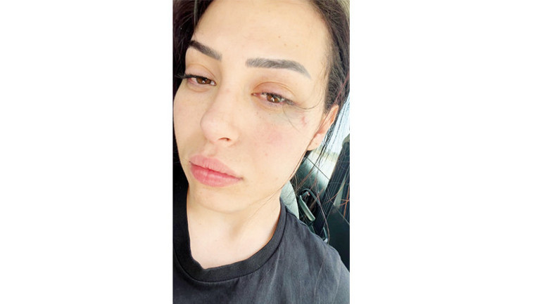 Asya’ya yumruklu saldırı Adada tansiyonu yükselten kavga