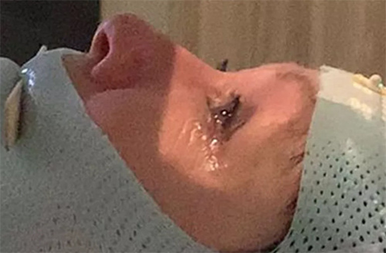 Bu dizide oynayanın yüzü gülmedi: Kötü haberi böyle duyurdu: Hastalık beynime sıçradı