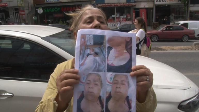 Diş tedavisine giden kadın kâbusu yaşadı... Narkoz sonrası yoğun bakıma alındı