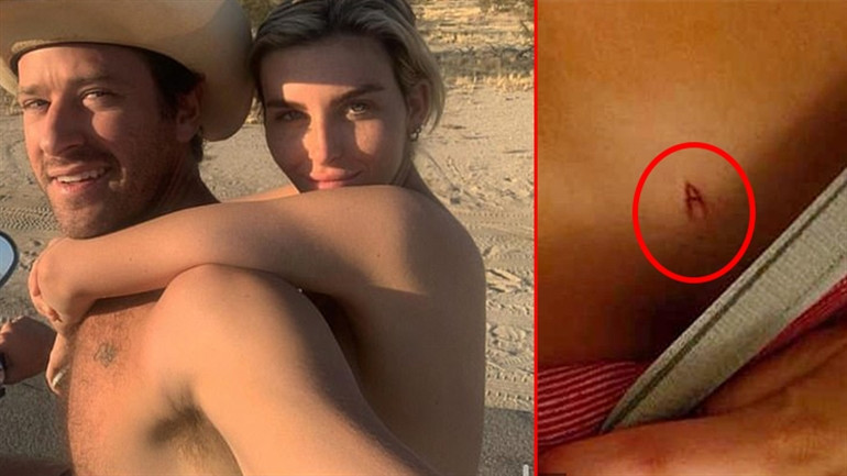 Ünlü aktöre açtığı tecavüz davasını kaybetmişti: Artık bütün erkeklerden korkuyorum