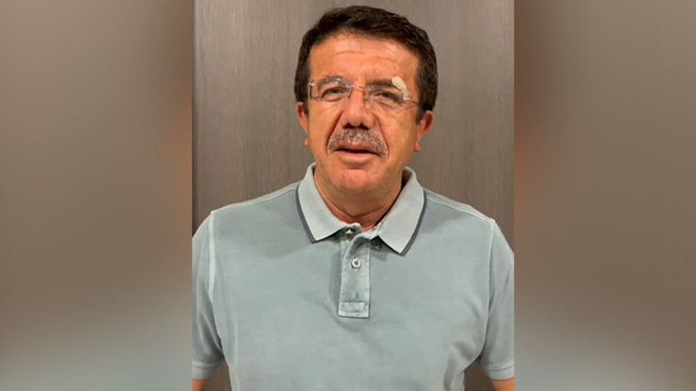 Eski Bakan Zeybekci kazada yaralandı