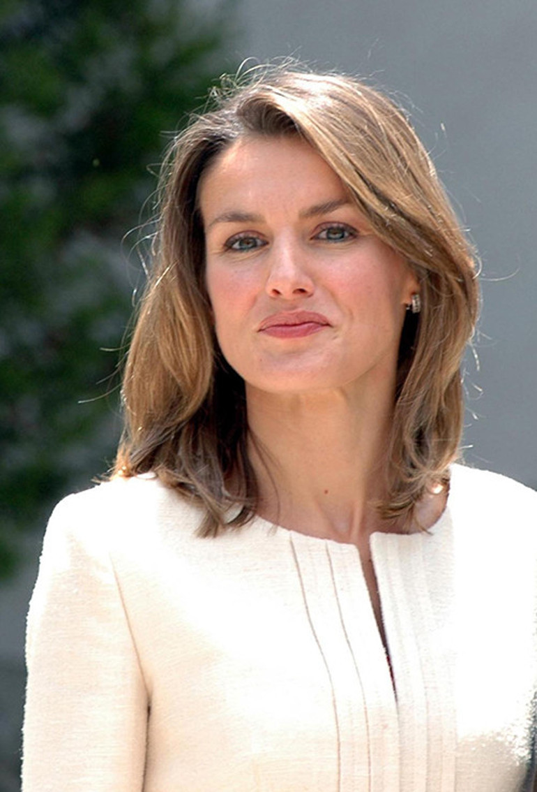 Kraliçeler zirvesine damga vuran soru: İkisine de aynı cerrah mı bakıyor