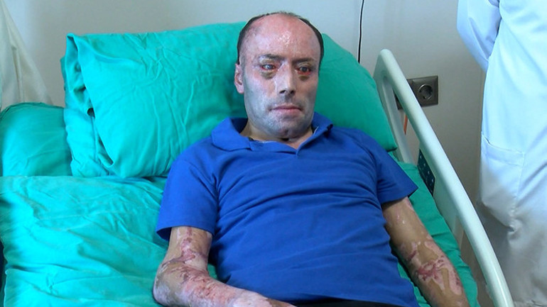 Bartında maden kazasında yaralanmıştı... Bakan Kocadan mesaj