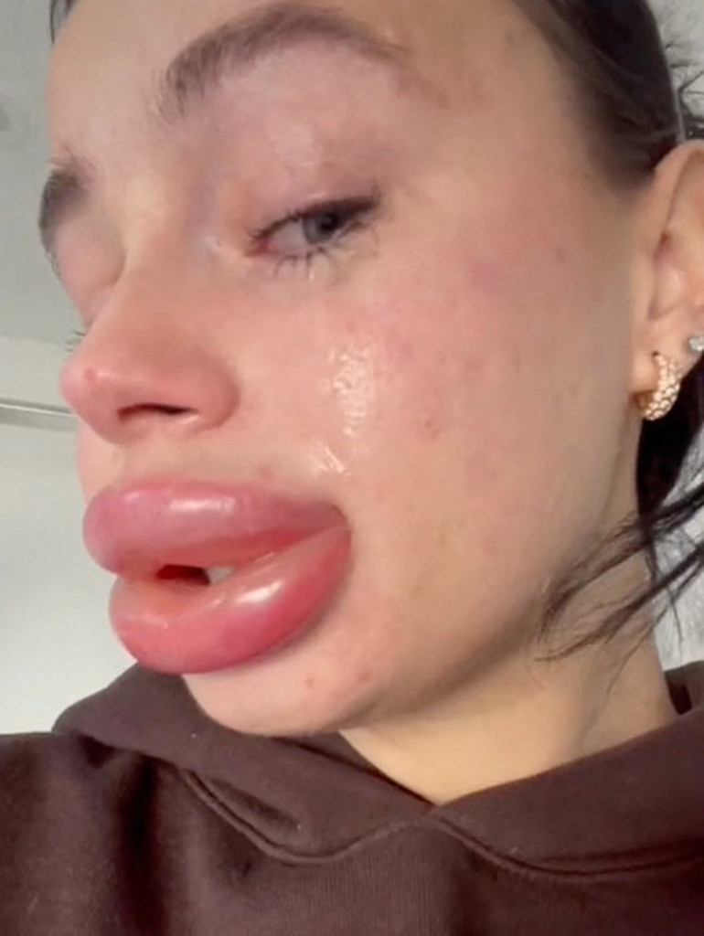 Bedava dolgu kabusundan zor uyandı