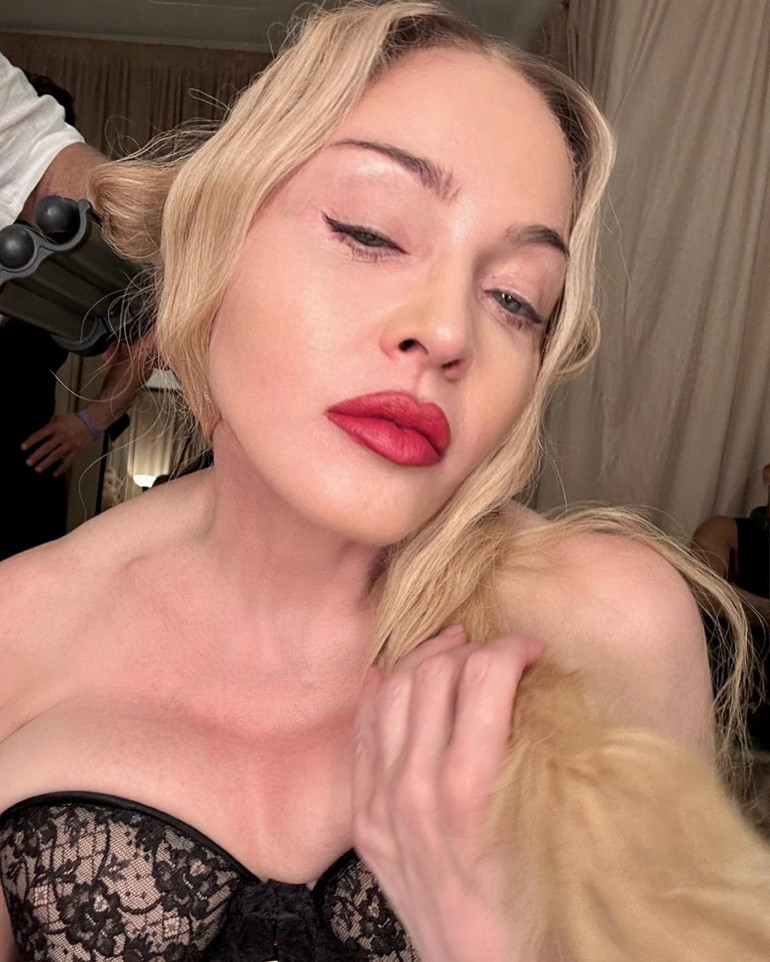 Yoğun bakıma kaldırılan Madonna’nın ailesinden ilk açıklama: Onu kaybedeceğimizden emindik, ölene kadar durmayacak