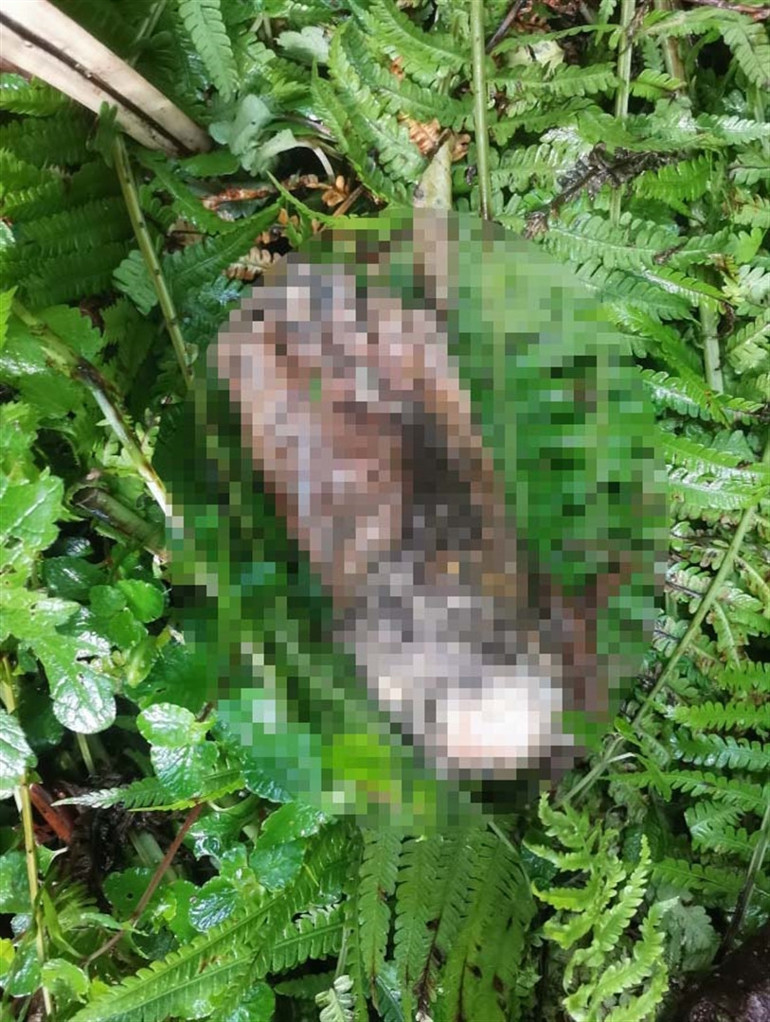 Artvinde kopmuş ayak bulunmuştu Bir aile DNA başvurusunda bulundu