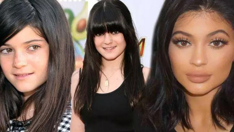 Kylie Jenner’dan beklenen itiraf geldi: Operasyon geçirdim ama pişmanım