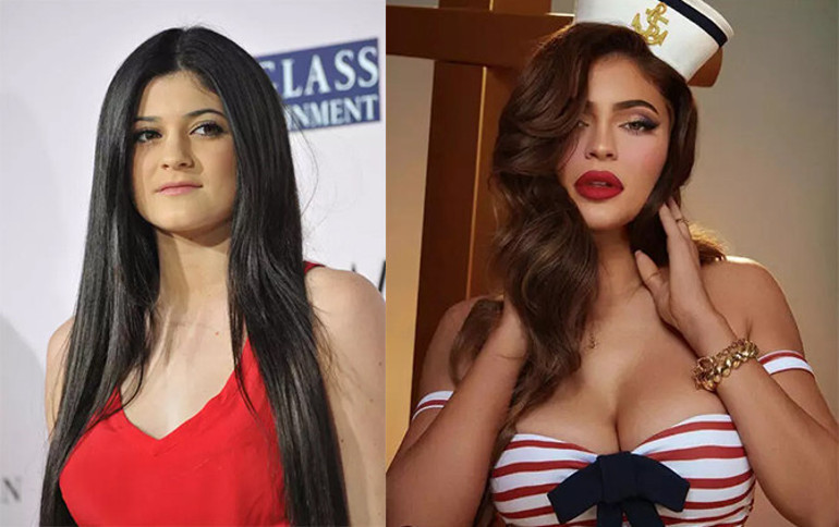 Kylie Jenner’dan beklenen itiraf geldi: Operasyon geçirdim ama pişmanım