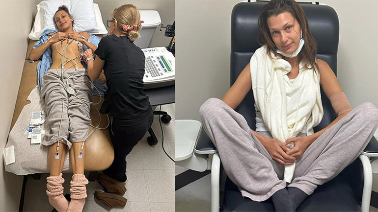 Ünlü model hastalığı yüzünden mesleğine ara vermişti: 15 yıldır her gün acı çekiyorum