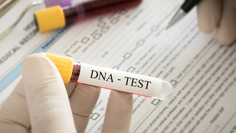 Yaptığım DNA testi hayatımı paramparça etti, annemin babamı aldatmış olmasından korkuyorum