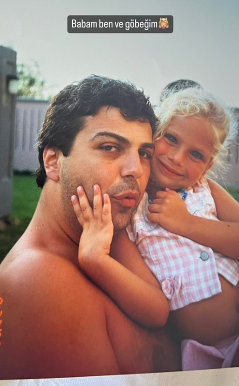 Bir dönem podyumda fırtına gibi esmişti... Estetik iddialarına çocukluk fotoğrafı ile yanıt verdi