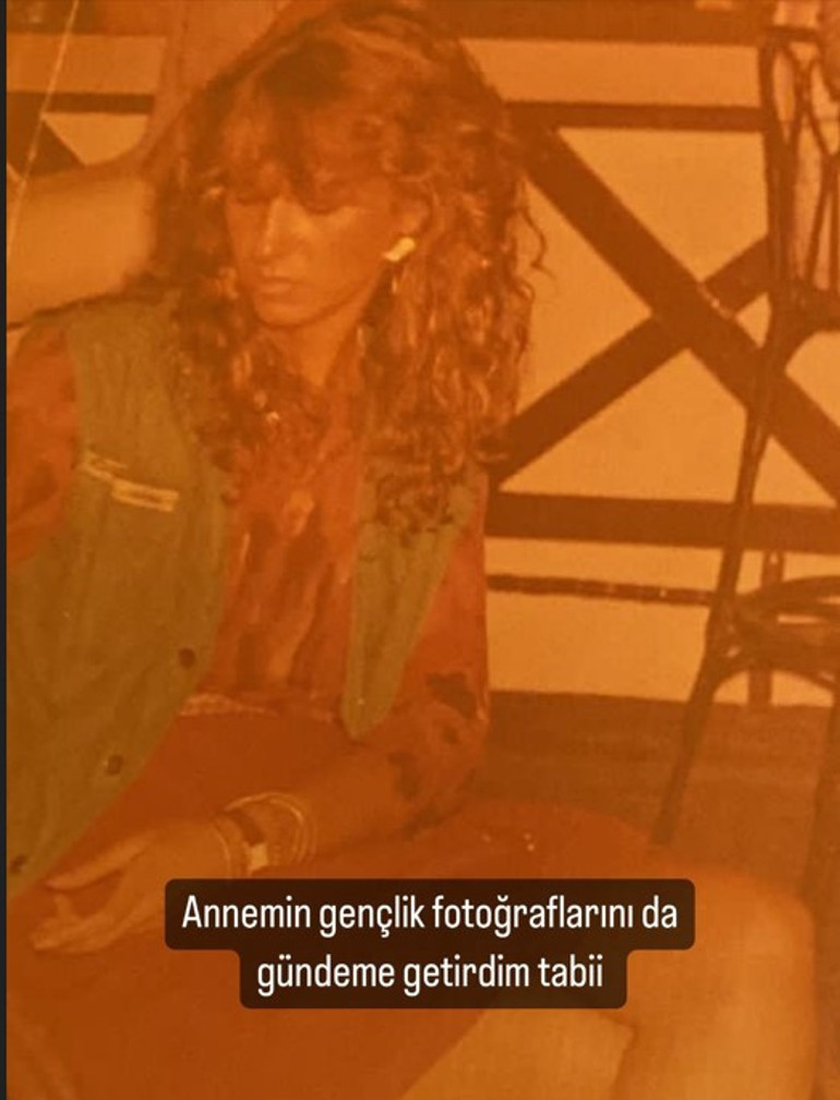 Bir dönem podyumda fırtına gibi esmişti... Estetik iddialarına çocukluk fotoğrafı ile yanıt verdi