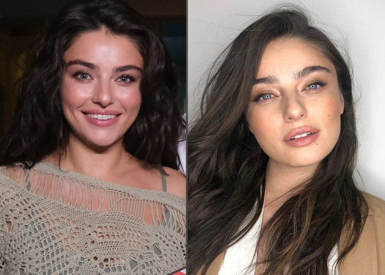 Son hali çok konuşulmuştu... Bengüden açıklama geldi