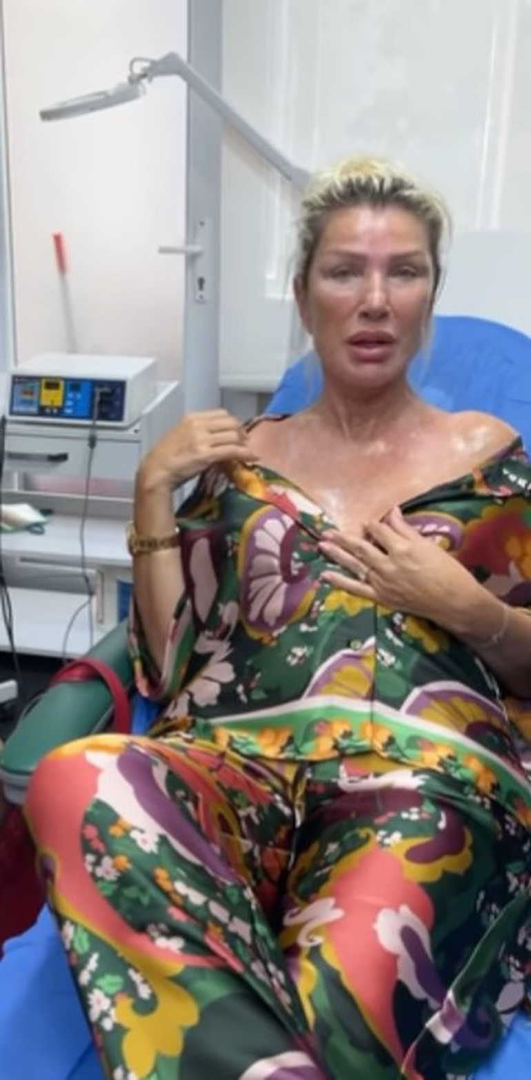 Yüzündeki değişim dikkat çekti... İşte yeni Ebru