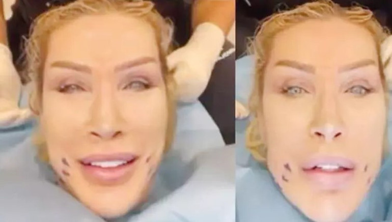 Son hali çok konuşulmuştu... Bengüden açıklama geldi