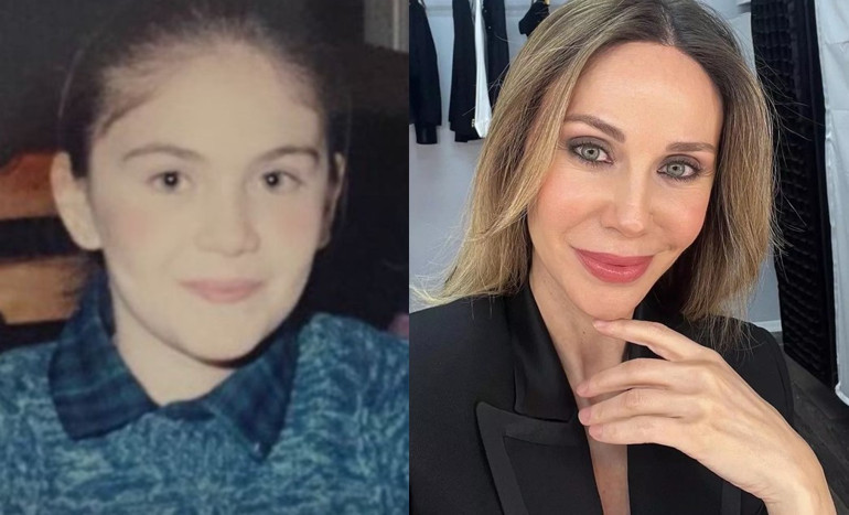 Bir dönem podyumda fırtına gibi esmişti... Estetik iddialarına çocukluk fotoğrafı ile yanıt verdi