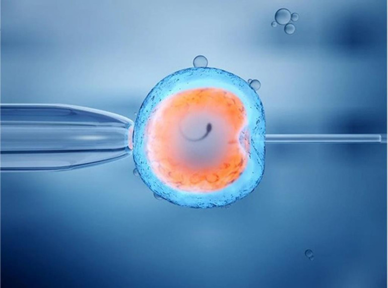 Tüp bebek soruları