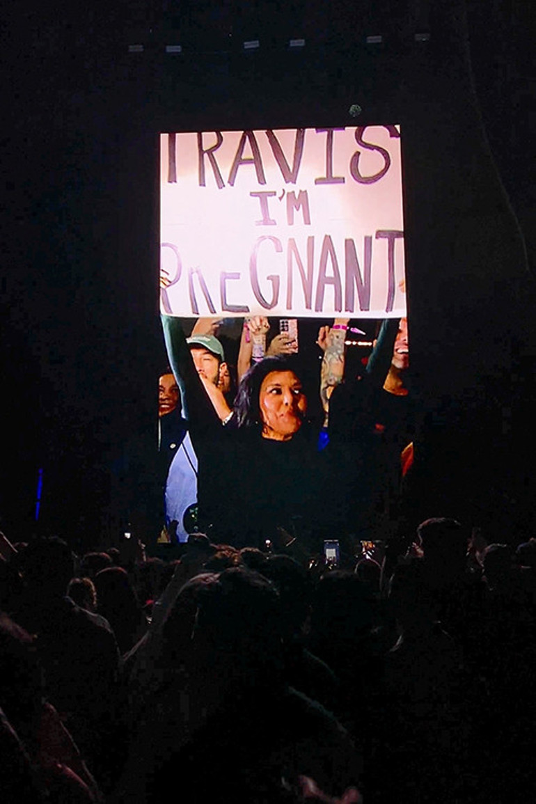 Ünlü yıldızın ömründen ömür gitti: Karnındaki bebeği ameliyat etmişler